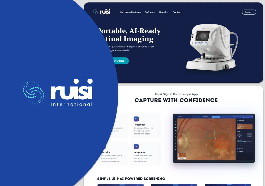 Fundoscope Website