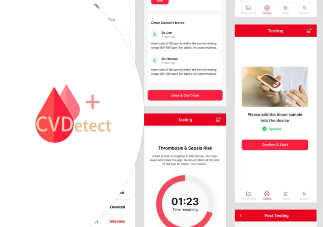 CVDetect (Kotlin Multiplatform)