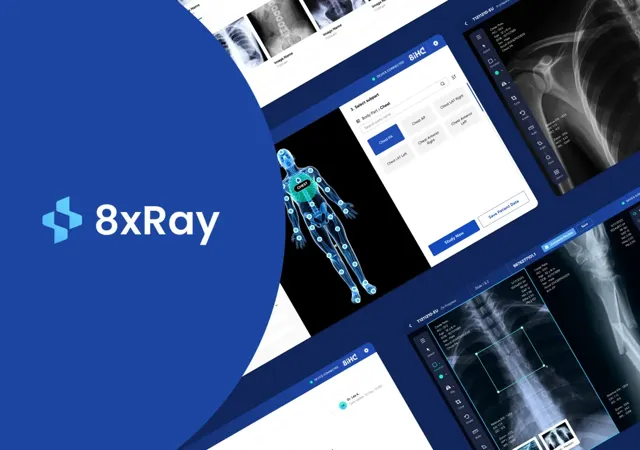 8xray App